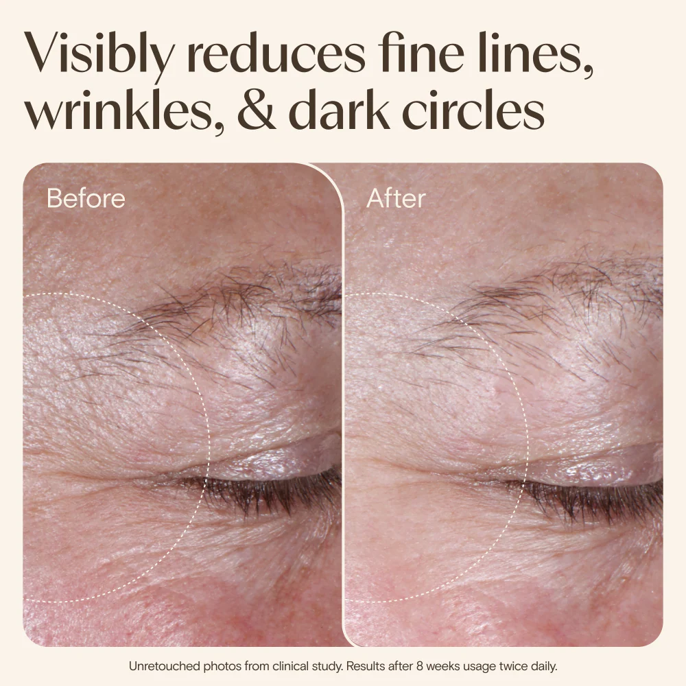 Aveeno Age Renewal Eye Gel Cream Retinol Alternative 15ml - Image 9