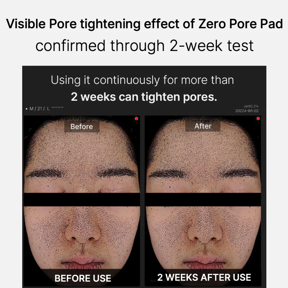 Medicube Zero Pore Pad 2.0 x70 - Image 7